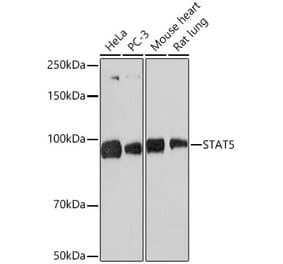 Western Blot - Anti-STAT5 Antibody [ARC1215] (A306462) - Antibodies.com