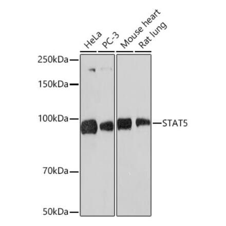 Western Blot - Anti-STAT5 Antibody [ARC1215] (A306462) - Antibodies.com