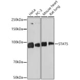 Western Blot - Anti-STAT5 Antibody [ARC1215] (A306462) - Antibodies.com