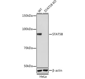 Western Blot - Anti-STAT5 Antibody [ARC0046] (A306463) - Antibodies.com