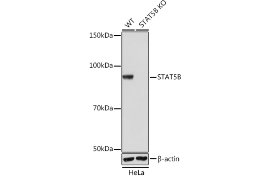 Western Blot - Anti-STAT5 Antibody [ARC0046] (A306463) - Antibodies.com