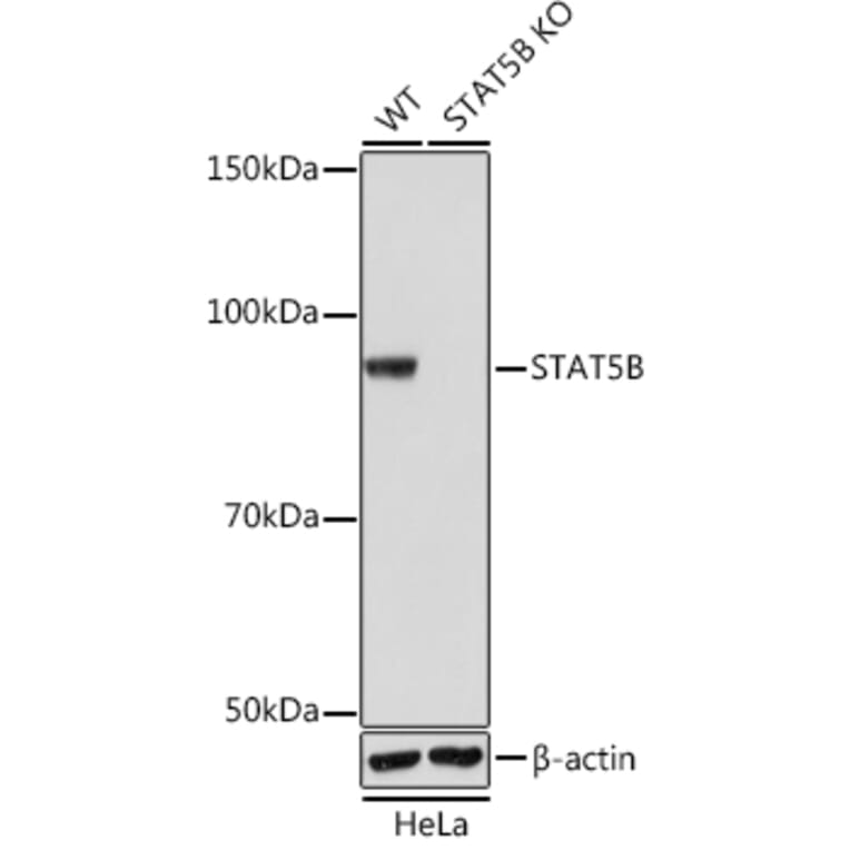 Western Blot - Anti-STAT5 Antibody [ARC0046] (A306463) - Antibodies.com