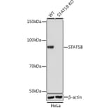 Western Blot - Anti-STAT5 Antibody [ARC0046] (A306463) - Antibodies.com