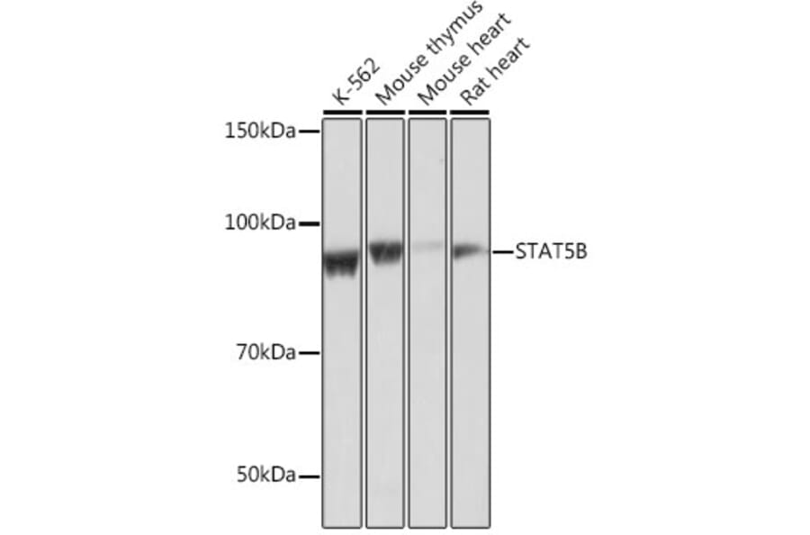 Western Blot - Anti-STAT5 Antibody [ARC0046] (A306463) - Antibodies.com