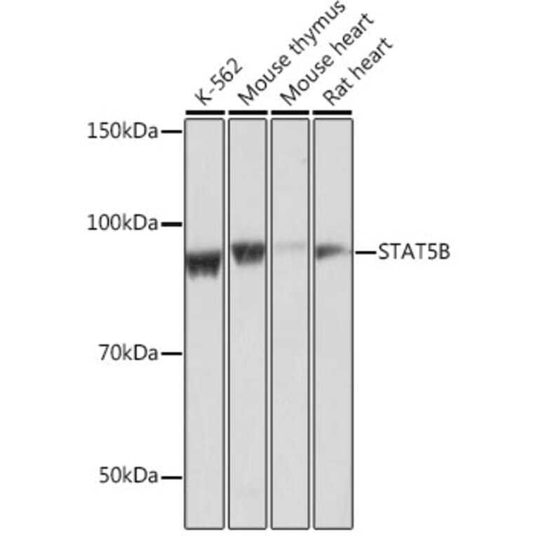 Western Blot - Anti-STAT5 Antibody [ARC0046] (A306463) - Antibodies.com