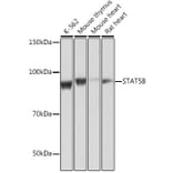 Western Blot - Anti-STAT5 Antibody [ARC0046] (A306463) - Antibodies.com