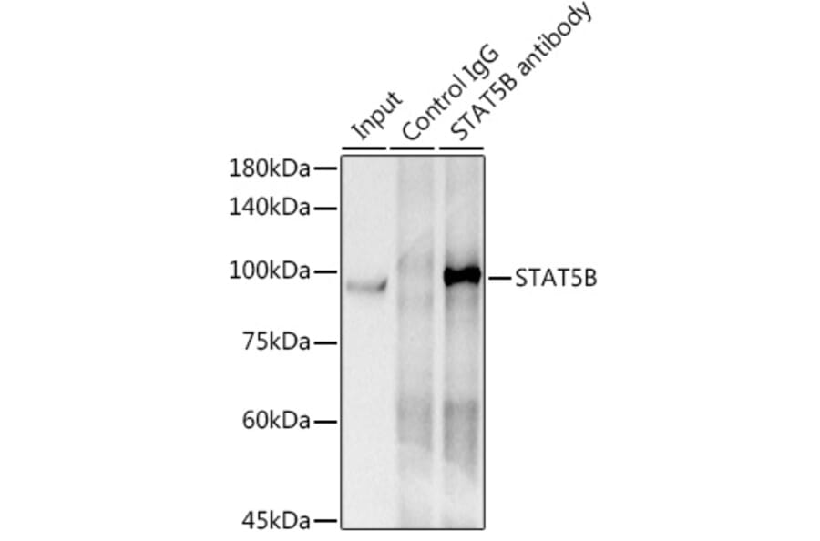 Western Blot - Anti-STAT5 Antibody [ARC0046] (A306463) - Antibodies.com