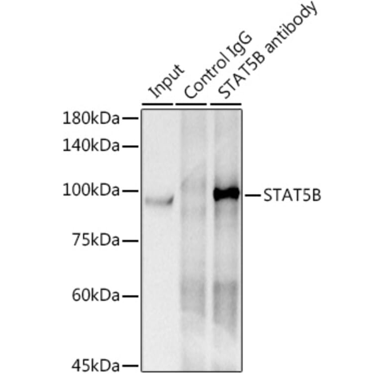 Western Blot - Anti-STAT5 Antibody [ARC0046] (A306463) - Antibodies.com