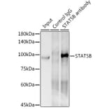Western Blot - Anti-STAT5 Antibody [ARC0046] (A306463) - Antibodies.com