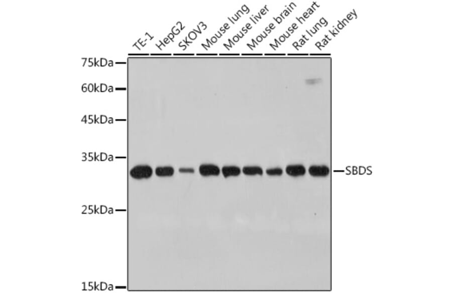 Western Blot - Anti-SBDS Antibody [ARC2539] (A306464) - Antibodies.com