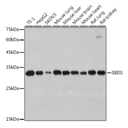 Western Blot - Anti-SBDS Antibody [ARC2539] (A306464) - Antibodies.com