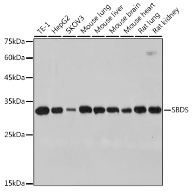 Western Blot - Anti-SBDS Antibody [ARC2539] (A306464) - Antibodies.com