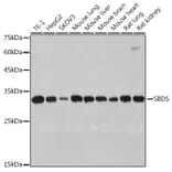 Western Blot - Anti-SBDS Antibody [ARC2539] (A306464) - Antibodies.com