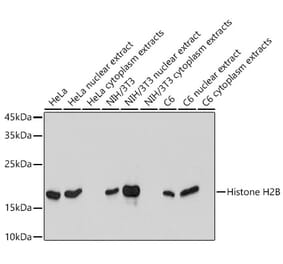 Western Blot - Anti-Histone H2B Antibody [ARC2337] (A306466) - Antibodies.com