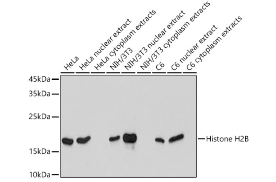 Western Blot - Anti-Histone H2B Antibody [ARC2337] (A306466) - Antibodies.com