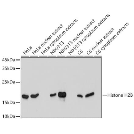 Western Blot - Anti-Histone H2B Antibody [ARC2337] (A306466) - Antibodies.com