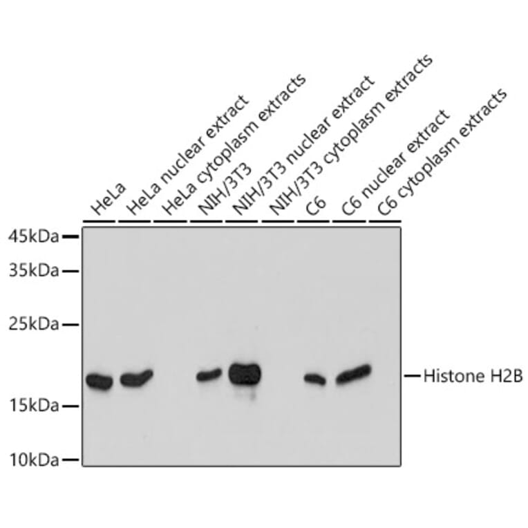 Western Blot - Anti-Histone H2B Antibody [ARC2337] (A306466) - Antibodies.com