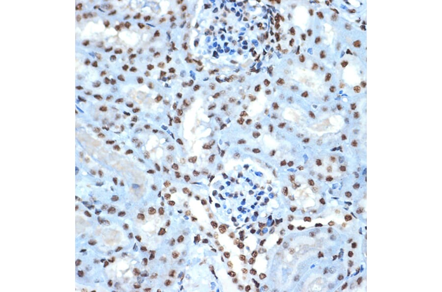 Immunohistochemistry - Anti-Histone H2B Antibody [ARC2337] (A306466) - Antibodies.com