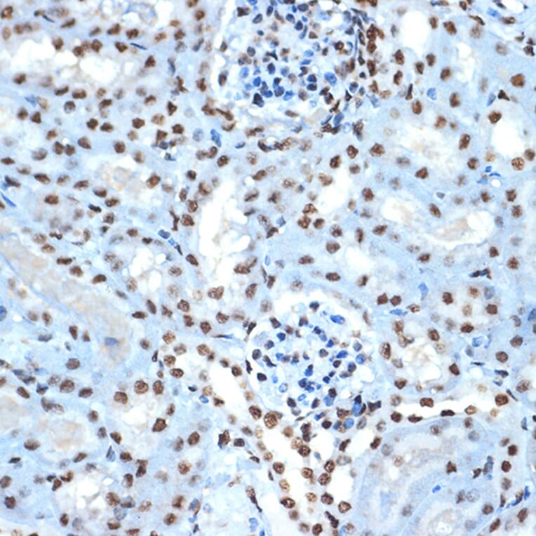 Immunohistochemistry - Anti-Histone H2B Antibody [ARC2337] (A306466) - Antibodies.com