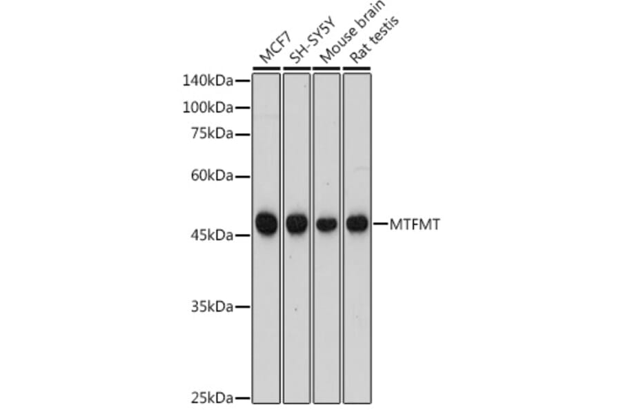 Western Blot - Anti-MTFMT/FMT Antibody (A306468) - Antibodies.com