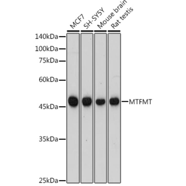 Western Blot - Anti-MTFMT/FMT Antibody (A306468) - Antibodies.com