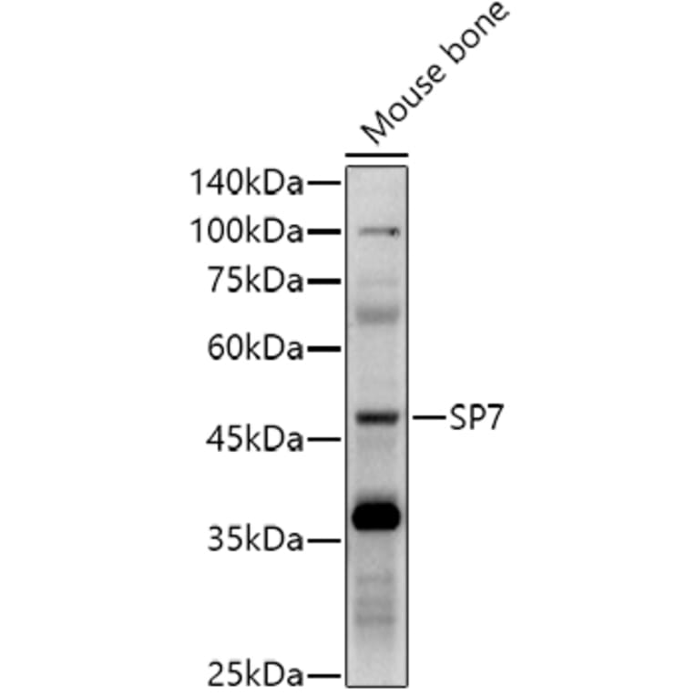 Western Blot - Anti-Sp7/Osterix Antibody (A306469) - Antibodies.com