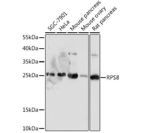 Western Blot - Anti-RPS8 Antibody (A306471) - Antibodies.com