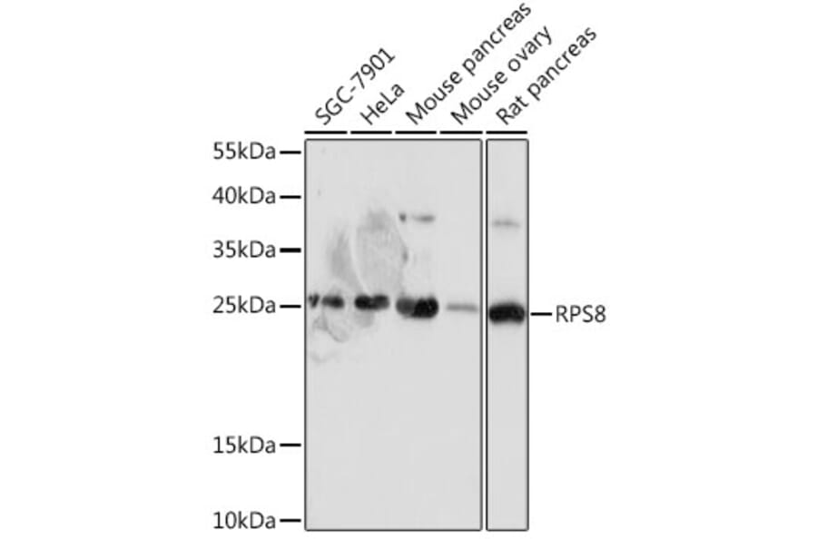 Western Blot - Anti-RPS8 Antibody (A306471) - Antibodies.com