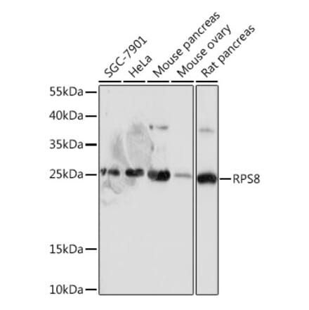 Western Blot - Anti-RPS8 Antibody (A306471) - Antibodies.com