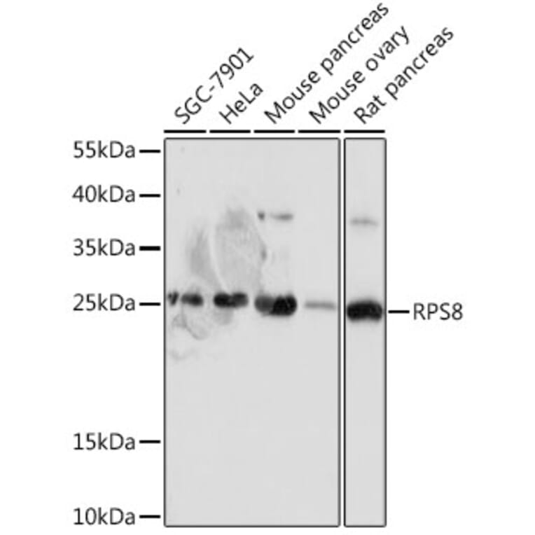 Western Blot - Anti-RPS8 Antibody (A306471) - Antibodies.com