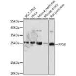 Western Blot - Anti-RPS8 Antibody (A306471) - Antibodies.com