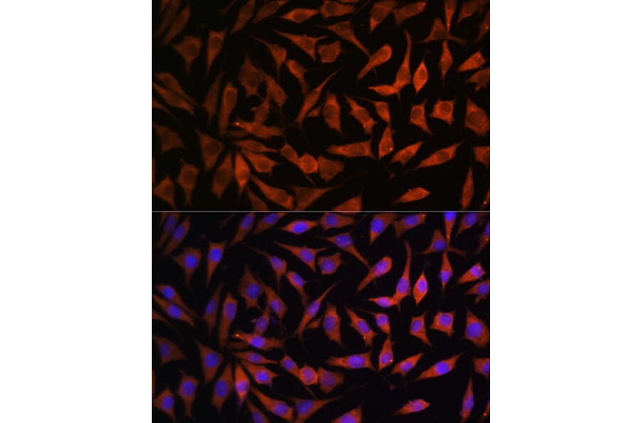 Immunofluorescence - Anti-RPS8 Antibody (A306471) - Antibodies.com