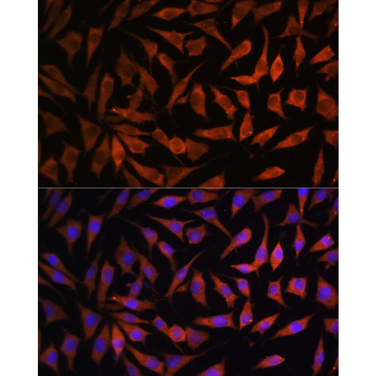 Immunofluorescence - Anti-RPS8 Antibody (A306471) - Antibodies.com