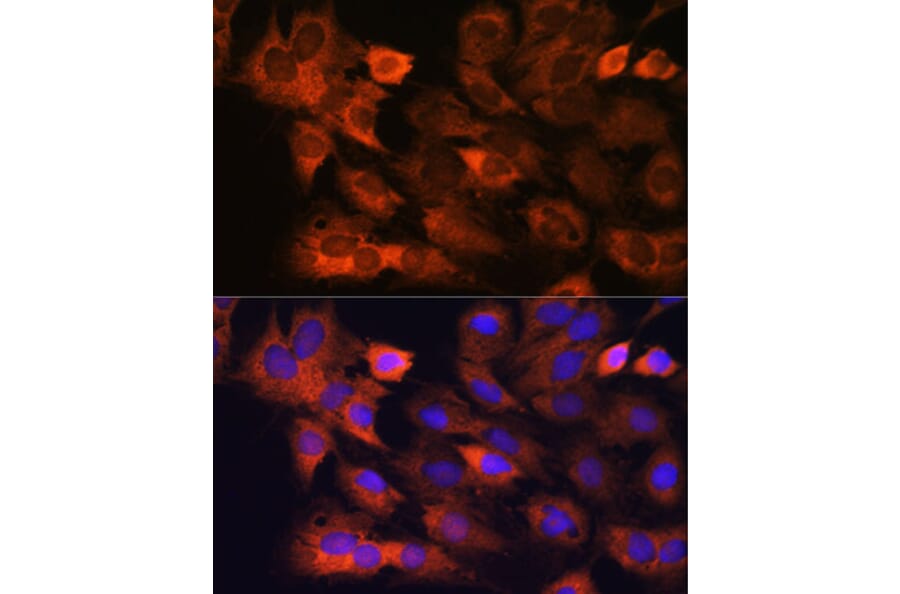 Immunofluorescence - Anti-RPS8 Antibody (A306471) - Antibodies.com