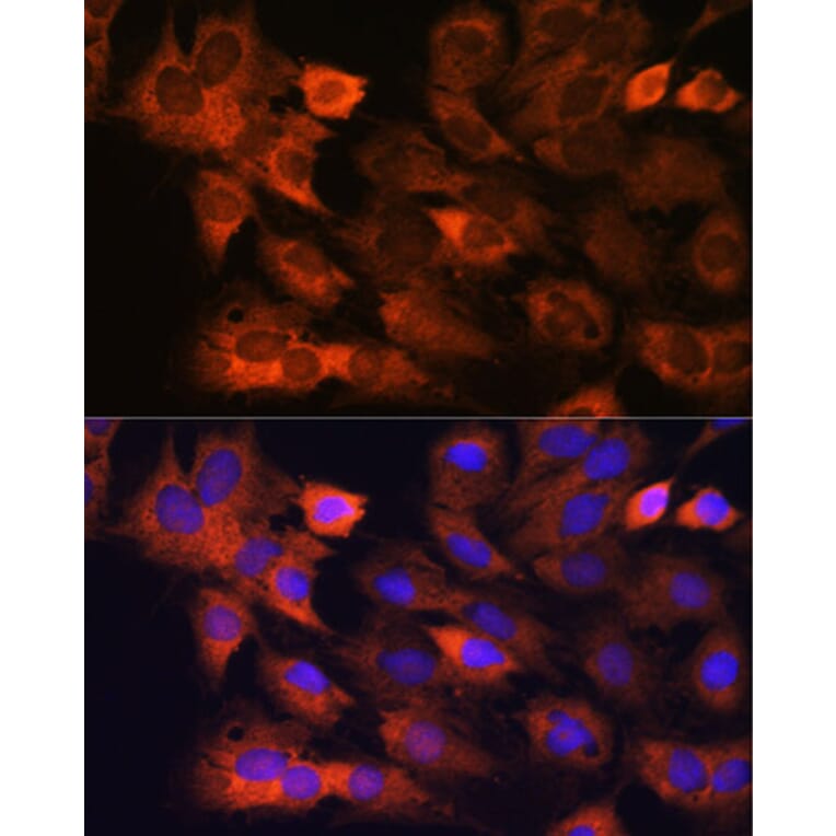 Immunofluorescence - Anti-RPS8 Antibody (A306471) - Antibodies.com