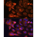 Immunofluorescence - Anti-RPS8 Antibody (A306471) - Antibodies.com