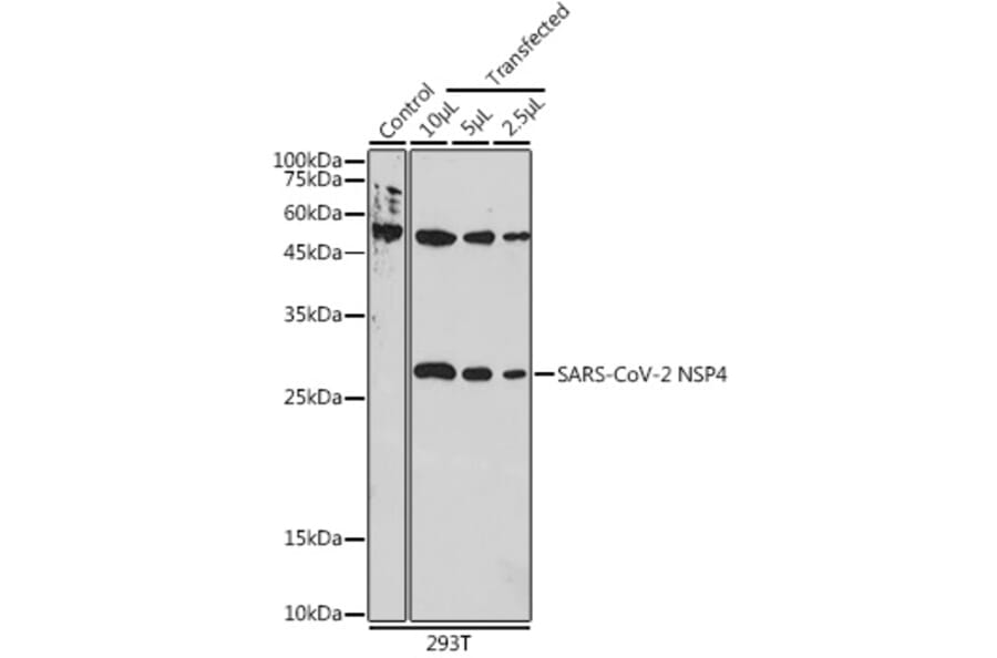 Western Blot - Anti-SARS-CoV2 NSP4 Antibody (A306472) - Antibodies.com
