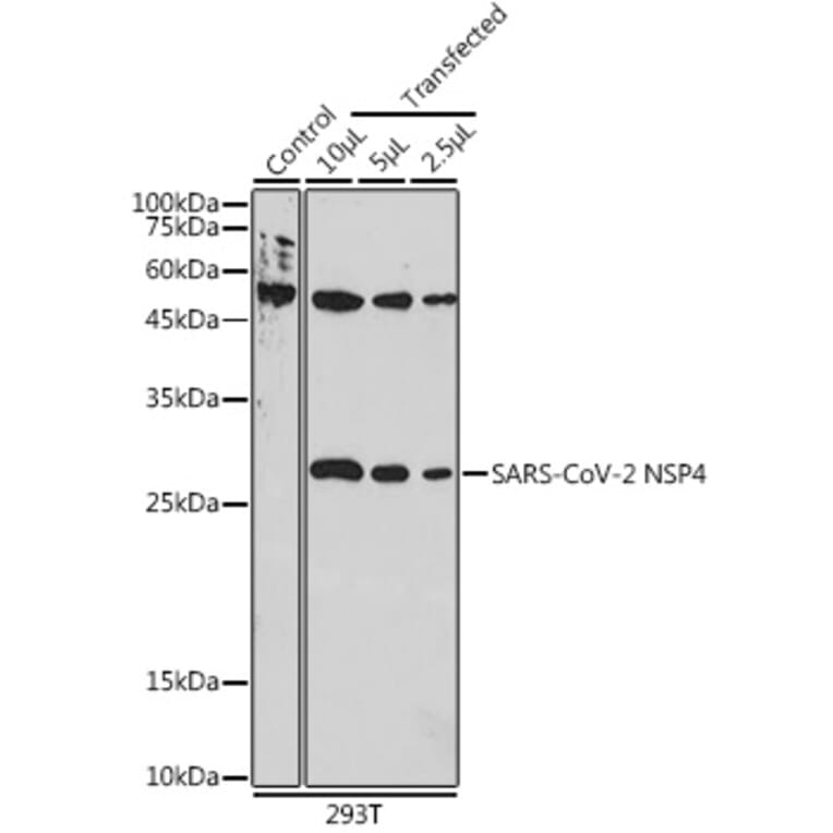Western Blot - Anti-SARS-CoV2 NSP4 Antibody (A306472) - Antibodies.com