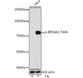 Western Blot - Anti-PKR (phospho Thr446) Antibody [ARC0293] (A306474) - Antibodies.com
