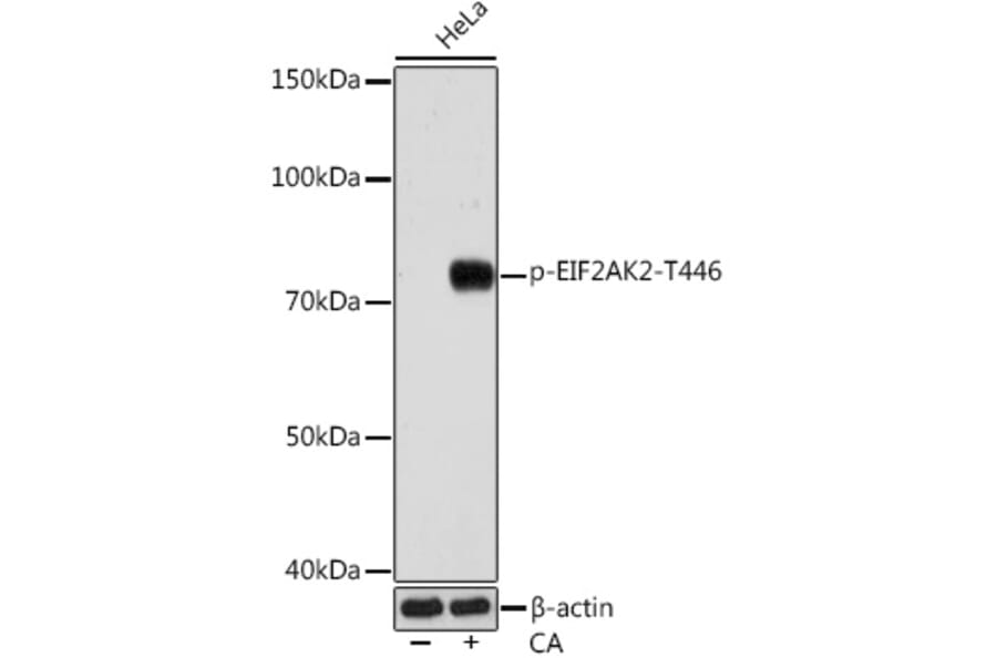 Western Blot - Anti-PKR (phospho Thr446) Antibody [ARC0293] (A306474) - Antibodies.com