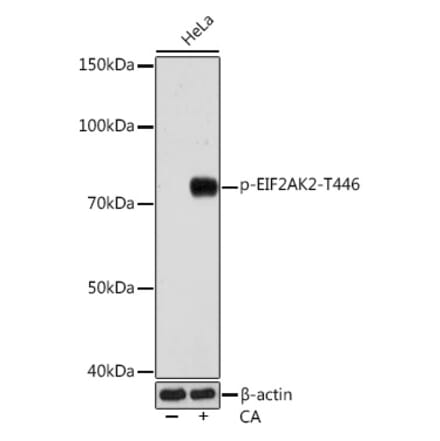 Western Blot - Anti-PKR (phospho Thr446) Antibody [ARC0293] (A306474) - Antibodies.com