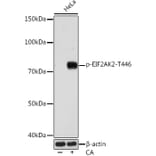 Western Blot - Anti-PKR (phospho Thr446) Antibody [ARC0293] (A306474) - Antibodies.com