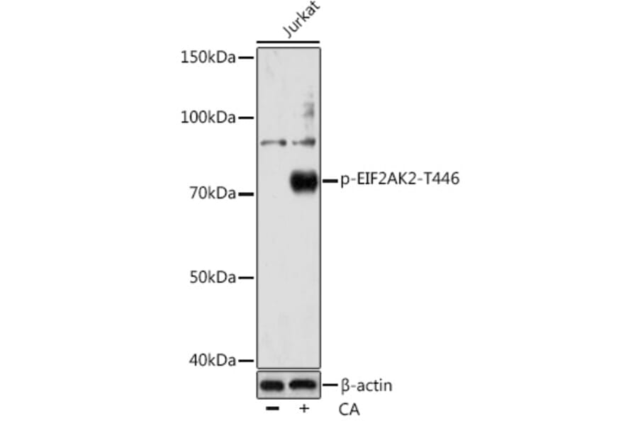 Western Blot - Anti-PKR (phospho Thr446) Antibody [ARC0293] (A306474) - Antibodies.com