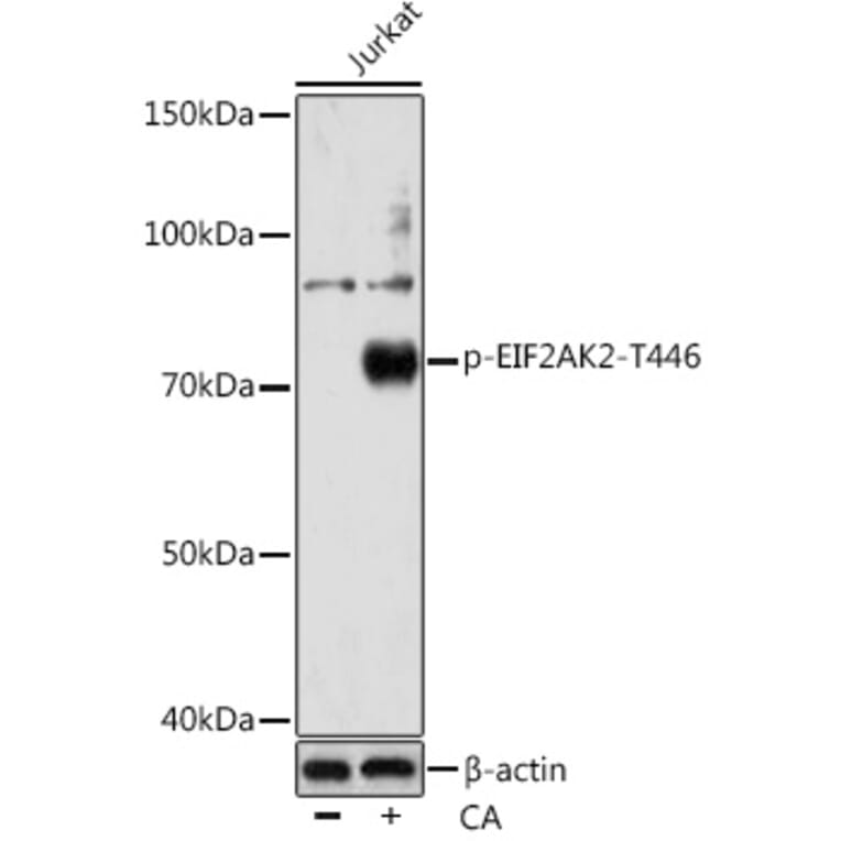 Western Blot - Anti-PKR (phospho Thr446) Antibody [ARC0293] (A306474) - Antibodies.com