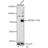 Western Blot - Anti-PKR (phospho Thr446) Antibody [ARC0293] (A306474) - Antibodies.com