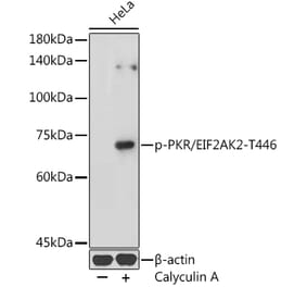Western Blot - Anti-PKR (phospho Thr446) Antibody (A306475) - Antibodies.com