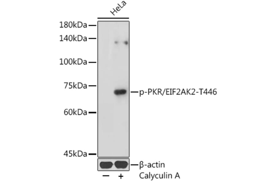 Western Blot - Anti-PKR (phospho Thr446) Antibody (A306475) - Antibodies.com