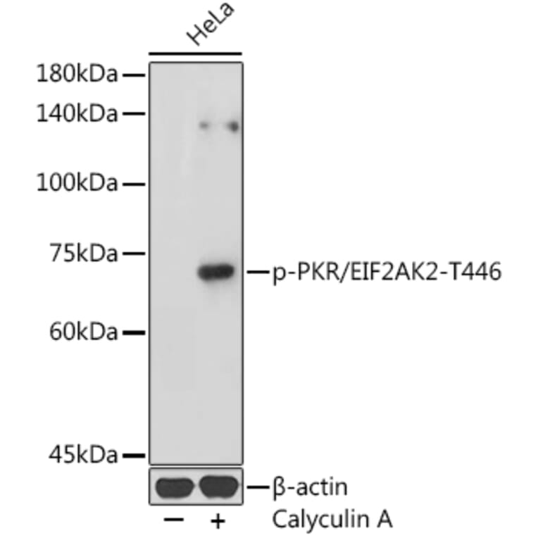 Western Blot - Anti-PKR (phospho Thr446) Antibody (A306475) - Antibodies.com