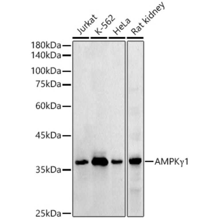 Western Blot - Anti-AMPK gamma 1 Antibody (A306476) - Antibodies.com