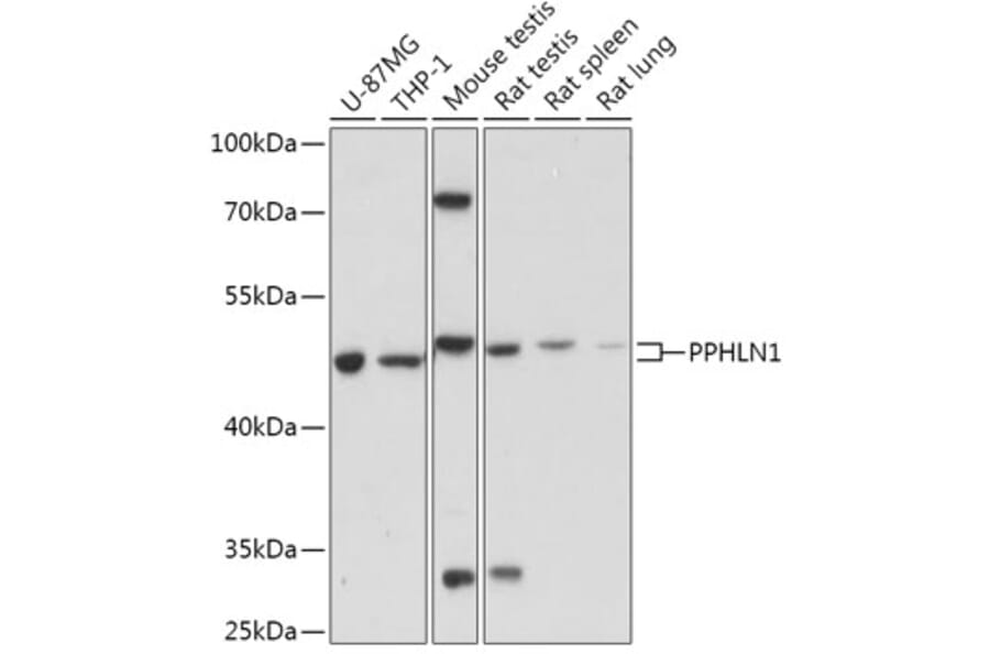 Western Blot - Anti-PPHLN1/Periphilin-1 Antibody (A306477) - Antibodies.com